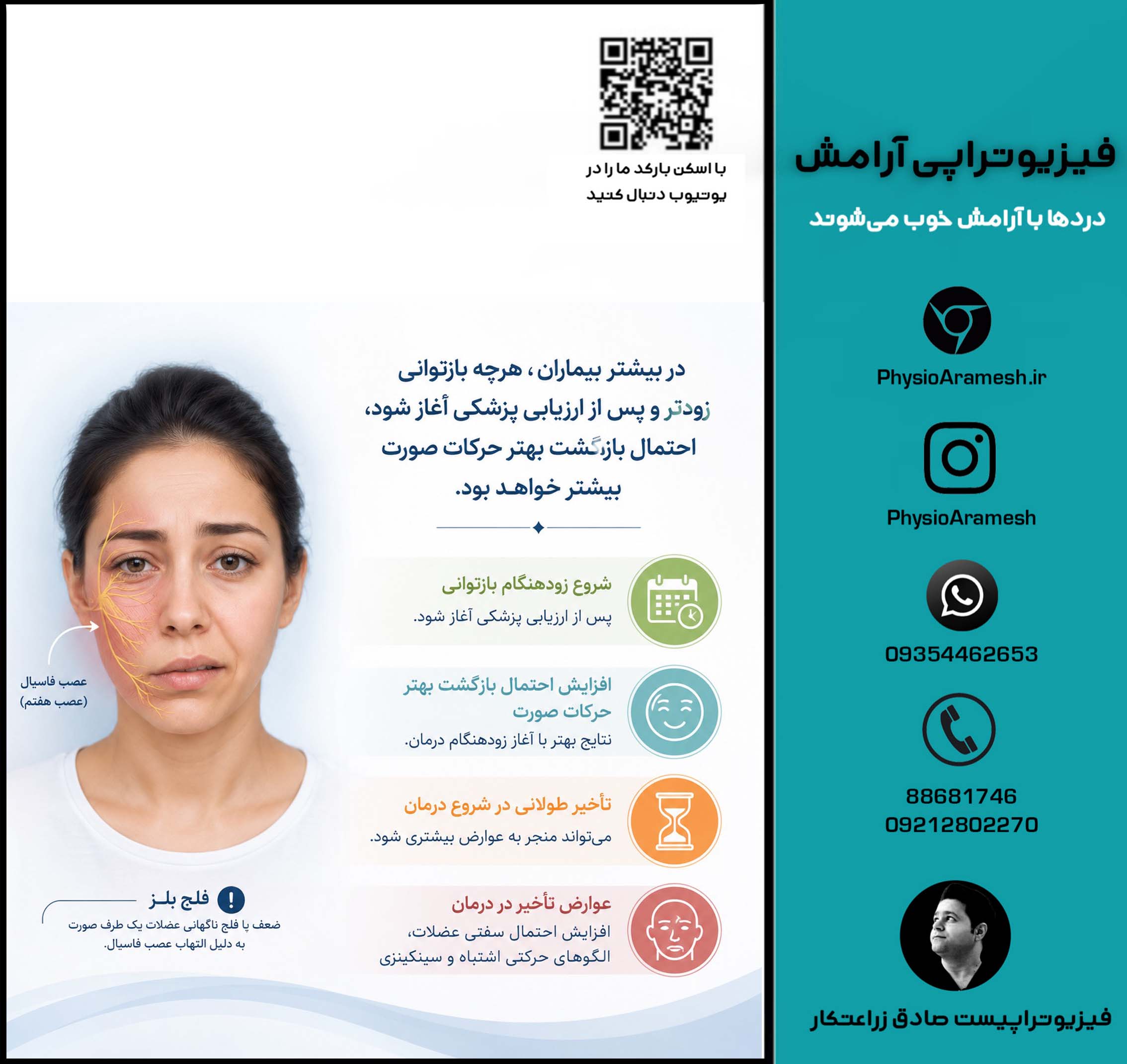 مزایای درمان زودهنگام فلج بلز